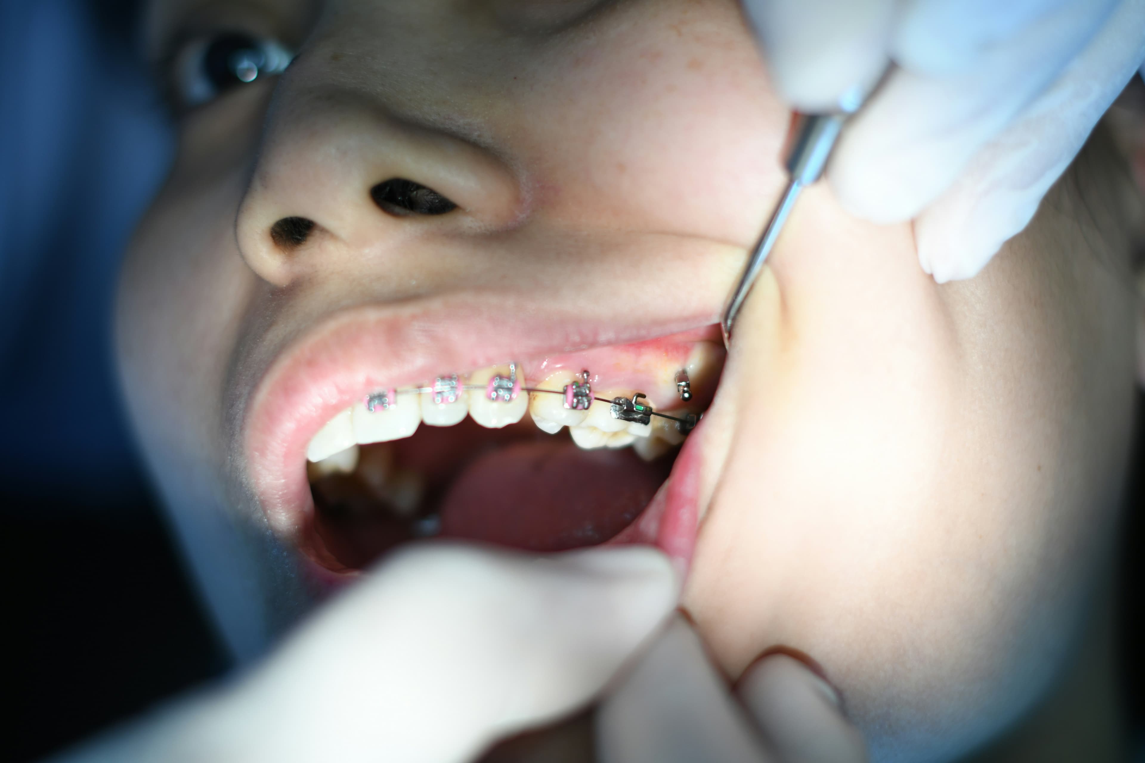 SmileCare Dental project preview